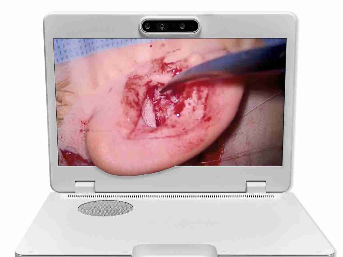 达擎之＂Heads-up 3D显微手术显示系统＂，，整合4K裸眼3D显示及眼球追踪系统，，，具备快速追踪人眼移动位置功能，，减轻医师长时间维持固定姿势的负担，，让医师能有更宽广清晰的3D立体视野及更舒适的姿势来执行手术。。